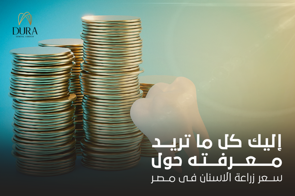 سعر زراعة الاسنان فى مصر