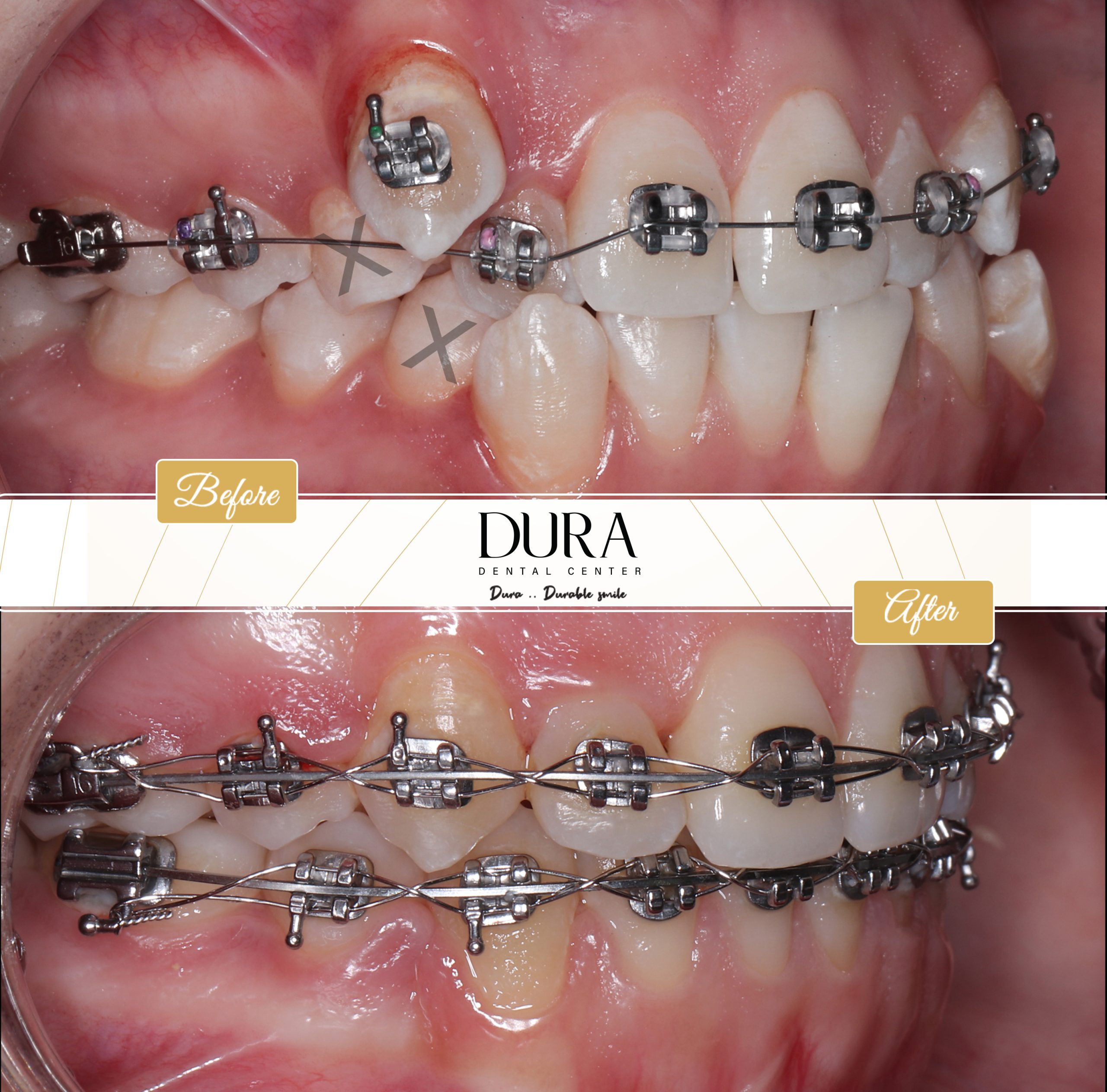 Dura Template 0012-Recovered-Recovered