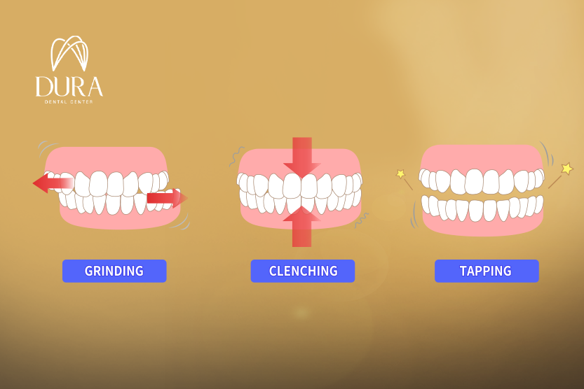 تقويم اسنان تجميلي