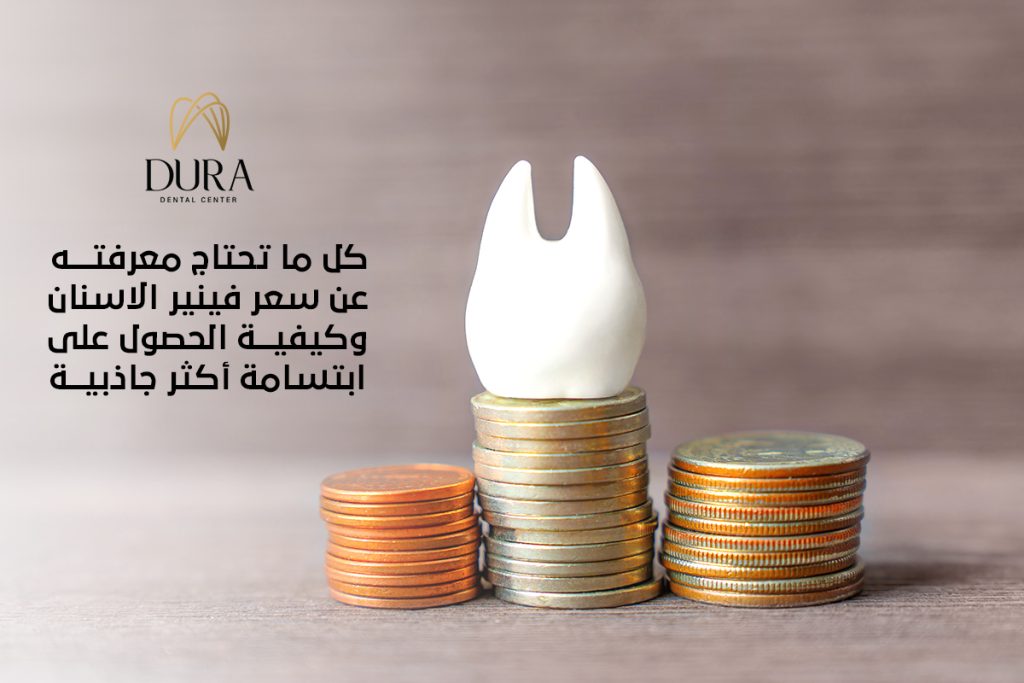 سعر فينير الاسنان