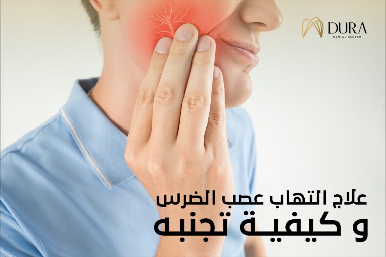 علاج التهاب العصب الضرس