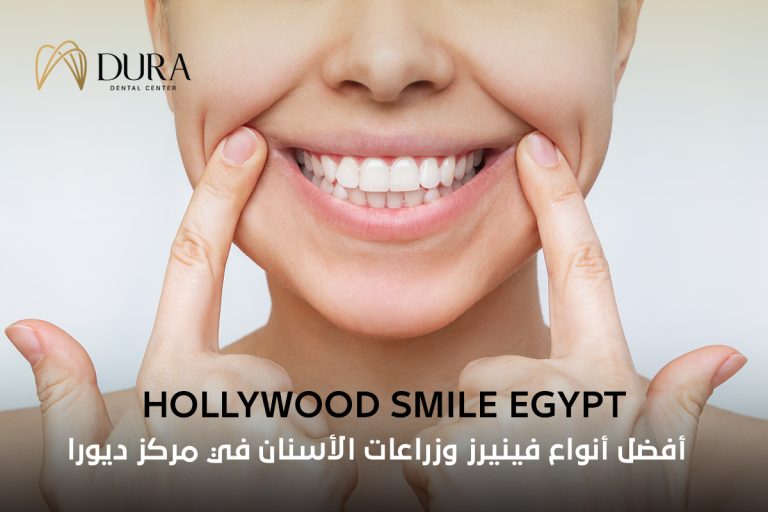 hollywood smile egypt