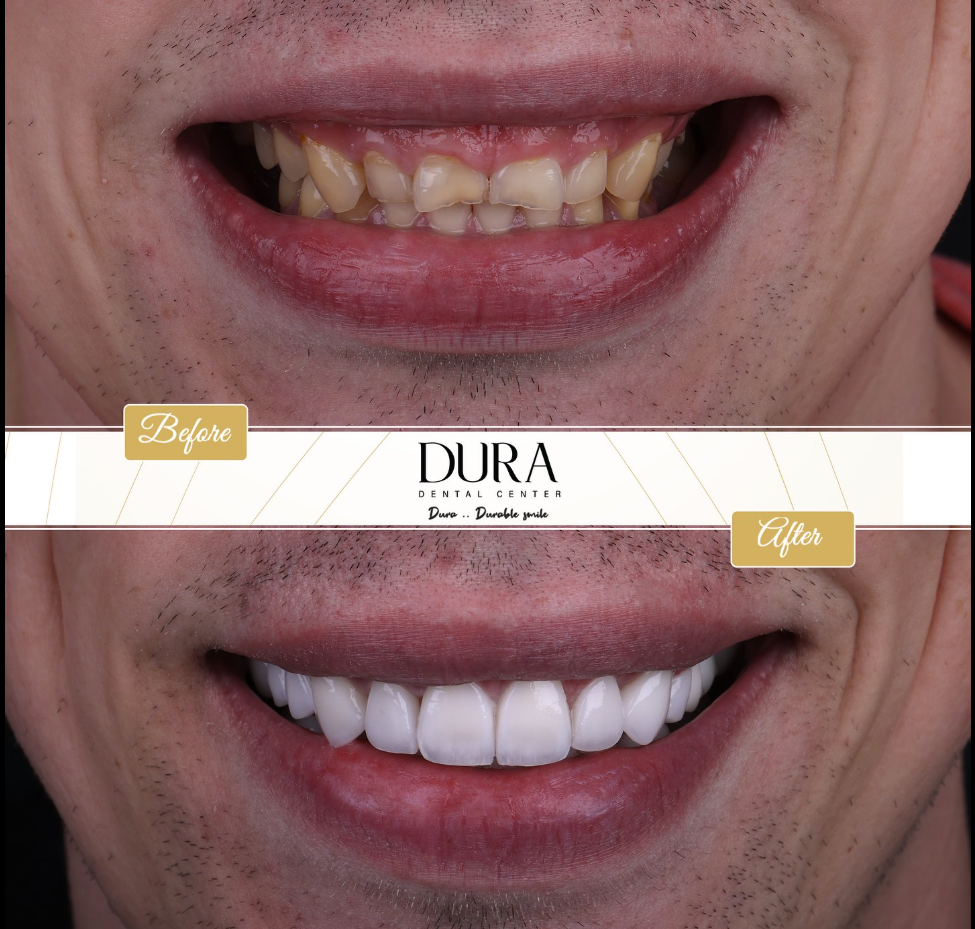 img diora 2
