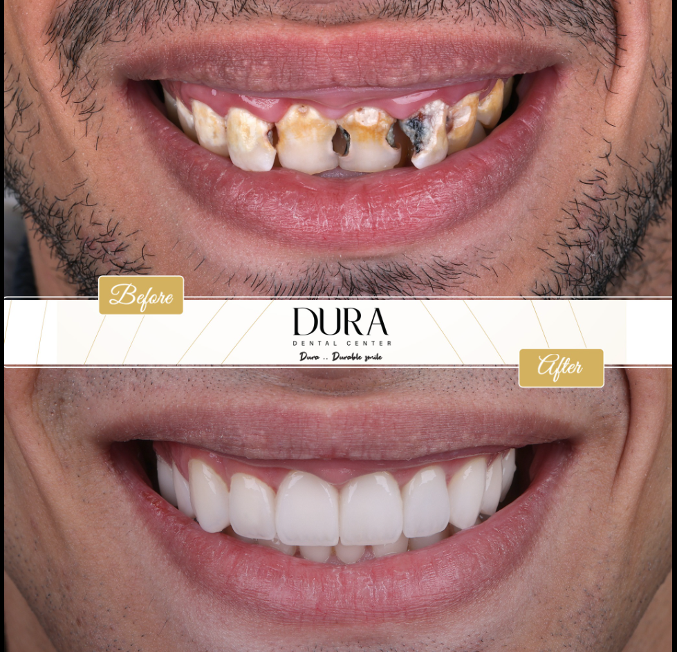 img diora 3