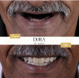 img diora 5