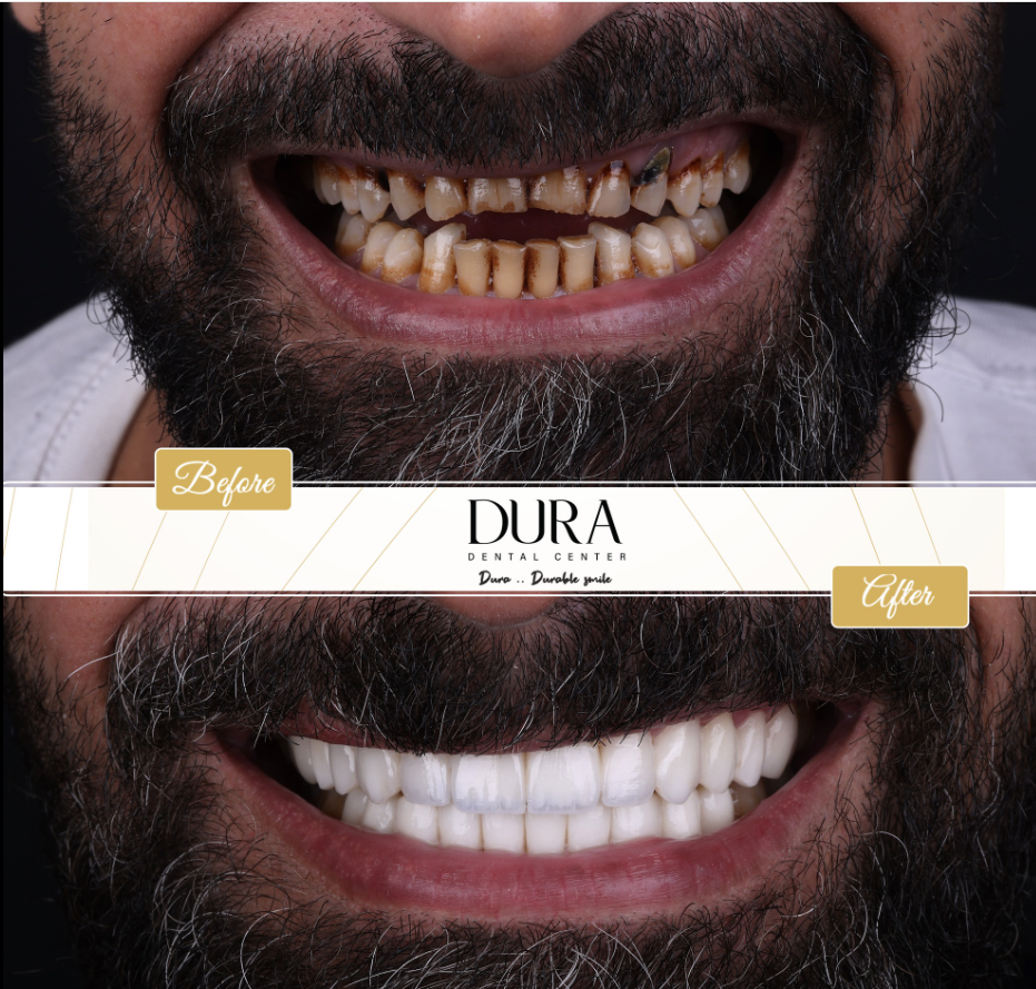 img diora 6