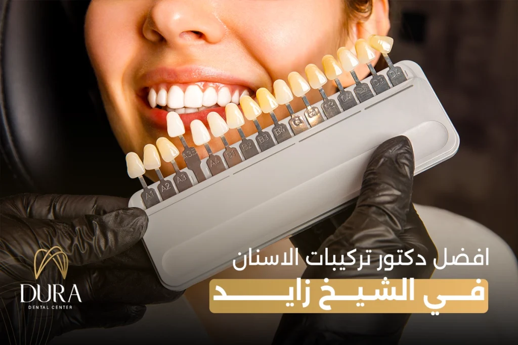 افضل دكتور تركيبات الاسنان في الشيخ زايد