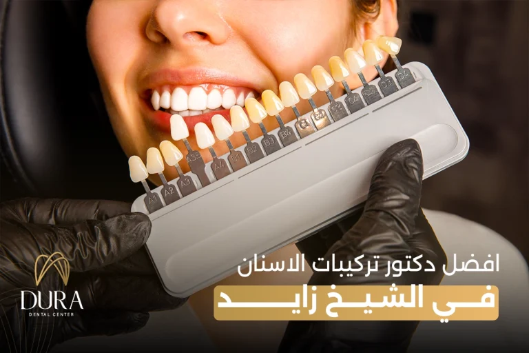 افضل دكتور تركيبات الاسنان في الشيخ زايد
