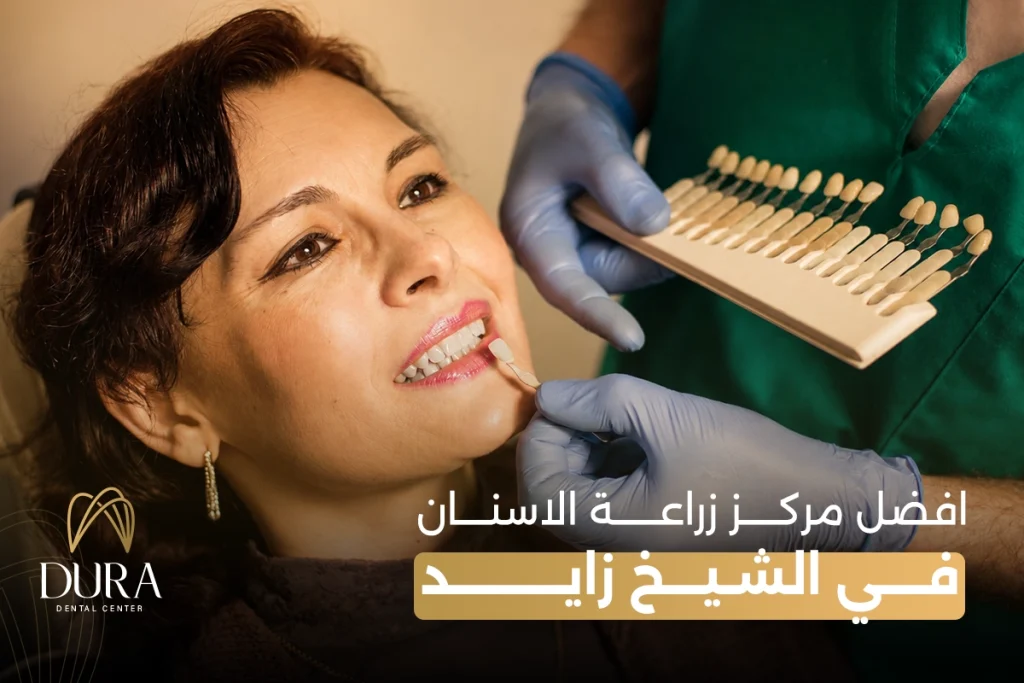 أفضل مركز زراعة اسنان فى الشيخ زايد